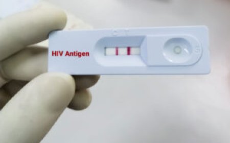 Medic Arrested for Blackmailing Client with Sex in Exchange of Negative HIV Results