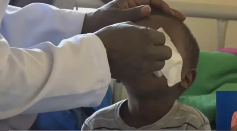 Baby Sagini with bandage on his eyes after his eyes were removed.